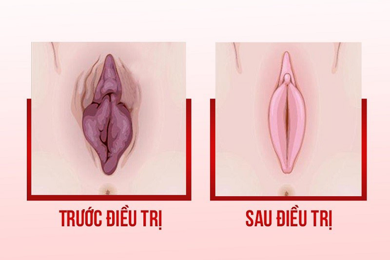 Tiến hành đánh bay thâm và giúp cô bé thêm hồng hào tự nhiên