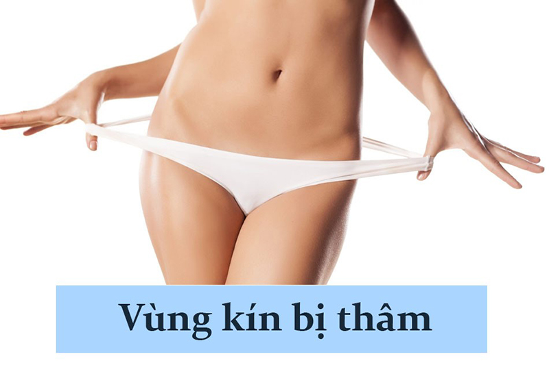 Cô bé bị thâm đen do các nguyên nhân khác nhau